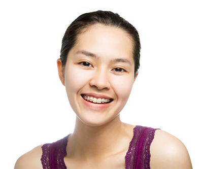 Young Woman with Clear Braces