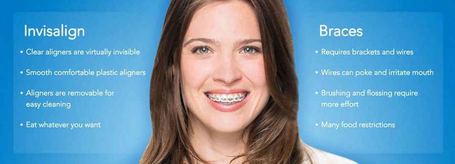 Woman with invisalign