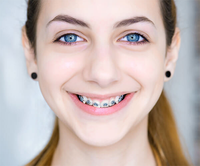 Young Girl Metal Braces