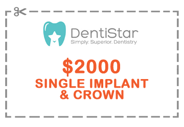 Crown or Implant in Glenview